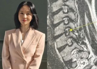 [데일리 헬스] 이정현, '이 질환'으로 몸 완전히 망가져...여름철 더 위험한 이유