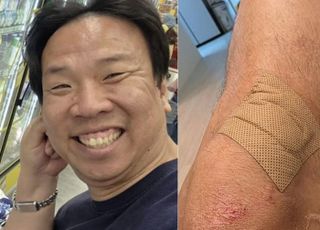 [데일리 헬스] 오지헌, 빗길에 결국 '이 사고' 당해..."미끄러져 핸들 놓쳐"