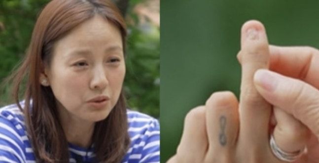 [데일리 헬스] 이효리, "손가락 신경 다 끊어지고 잘릴 뻔"...'이 사고'로 병원행