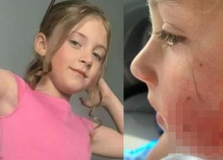 '할머니 집 놀러 갔다가' 8살 여아, 개에 공격당해…'개 물림 사고' 피하려면?