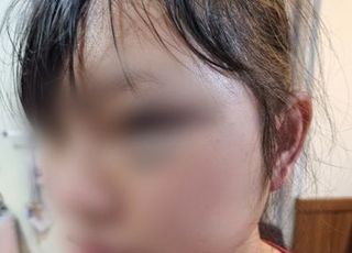 여성 이주노동자 얼굴 걷어찬 40대…檢, '징역 2년' 구형