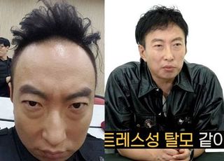 박명수 "일론 머스크 뭐 하나, '이것' 안 만들고" 호통…탈모에 가장 좋은 방법은? [데일리 헬스]