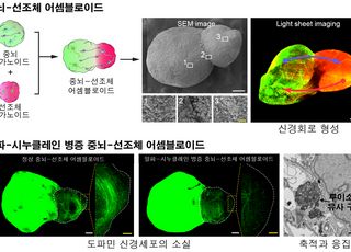 아주대의대, 세계 최초 '파킨슨병 병리 재현 인간 뇌 어셈블로이드' 개발