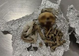 공항 세관서 사람 두개골 나왔다…"주술 의식에 사용하려고"