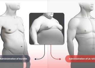 근육 늘리는 비만약 온다…한미약품, 美 FDA 임상 1상 신청
