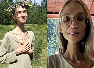 "난 과일주의자" 고수하더니…22kg 상태로 숨진 20대女