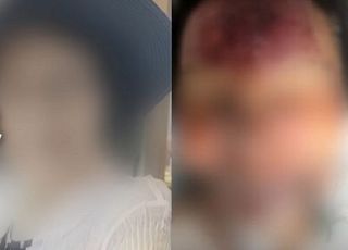 '100억 세 아들에 증여했는데' 얼굴에 멍자국 숨진 90대女…사건의 실체는?