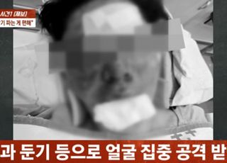 납치·폭행 '100만 유튜버' 피해 보니...얼굴 피투성이