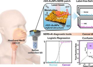 "타액 검사로 두경부암 진단"…서울성모병원, AI 플랫폼 개발