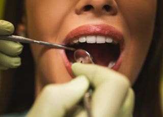 아직 안 받았다면...'스케일링' 꼭 받아야 하는 이유 [데일리 헬스]