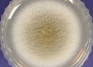 해양생물자원관, 아스파라긴에만 작용하는 항암 효소 규명