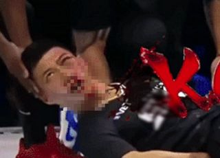 세계 따귀 대회서 상대 한 방에 K.O…처참해진 유명 무술가