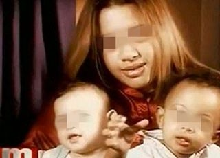 아빠가 다른 쌍둥이? "짧은 시간 내 둘 이상과 관계하면 가능..."