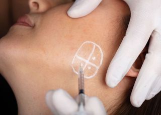 보톡스로 재미 좀 봤는데…국내 시장 포화에 해외로 발 돌리는 K-톡신