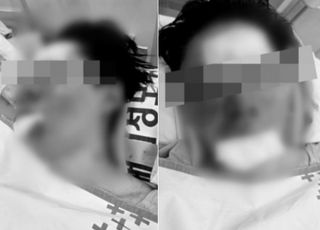 "맞아서 피범벅 된 얼굴…죽는구나 싶었다" 납치 당했던 100만 유튜버 심경