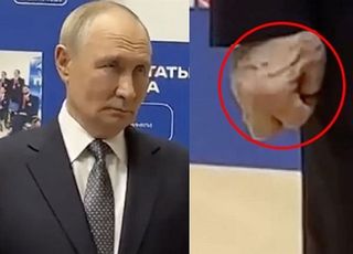 푸틴, 퉁퉁 부은 손 포착…건강 이상설 부추긴 '이 증상' 원인은? [데일리 헬스]