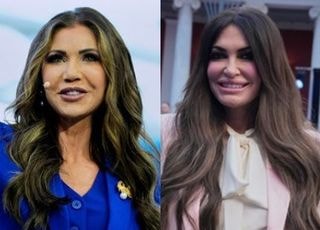 美서 유행 중인 '마러라고식 성형'...'과장된 스타일'이 특징?