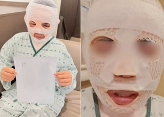 "딴 남자 만나지마" 연인 얼굴에 끓는 물 끼얹은 한국男