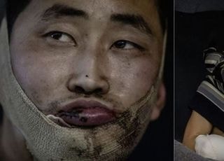 우크라 北 포로 2명 자필편지…"한국에서 살고파"