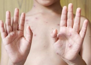 "낯선 사람과 잦은 성접촉, 특히 젊은 남자들" 난리 난 동아시아