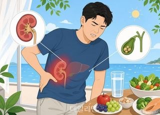 폭염에 들이키는 맥주·아이스커피…몸속에 '돌'이 쌓인다 [김효경의 데일리 헬스]